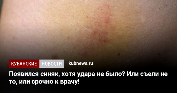 синяк