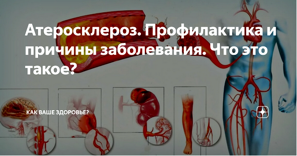 лечение