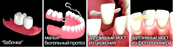 зубы