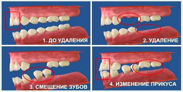 сон